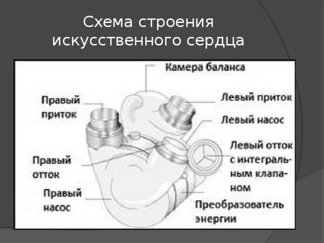 Искусственное сердце abiocor презентация