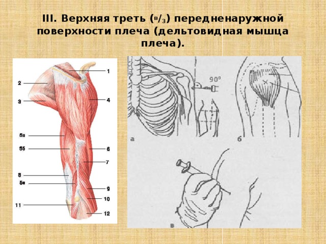 Средняя треть. Техника введения вакцины в дельтовидную мышцу. Внутримышечная инъекция в дельтовидную мышцу. Техника внутримышечной инъекции в дельтовидную мышцу. Инъекция в дельтовидную мышцу плеча.