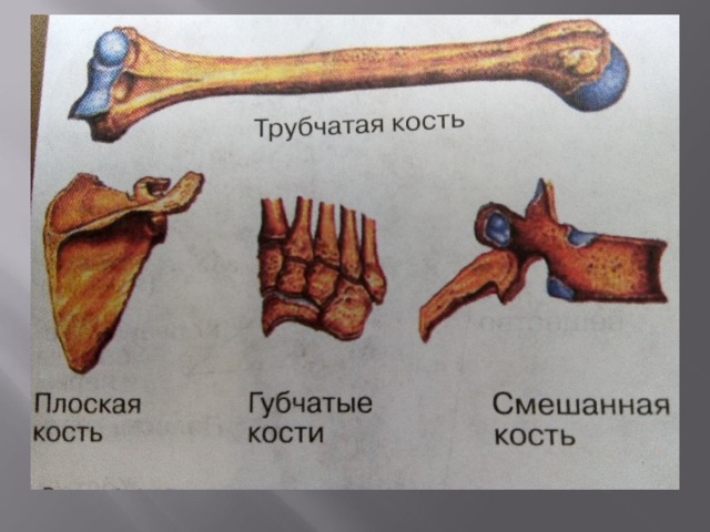 Определить кость по фото