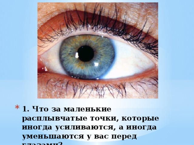 1. Что за маленькие расплывчатые точки, которые иногда усиливаются, а иногда уменьшаются у вас перед глазами? 