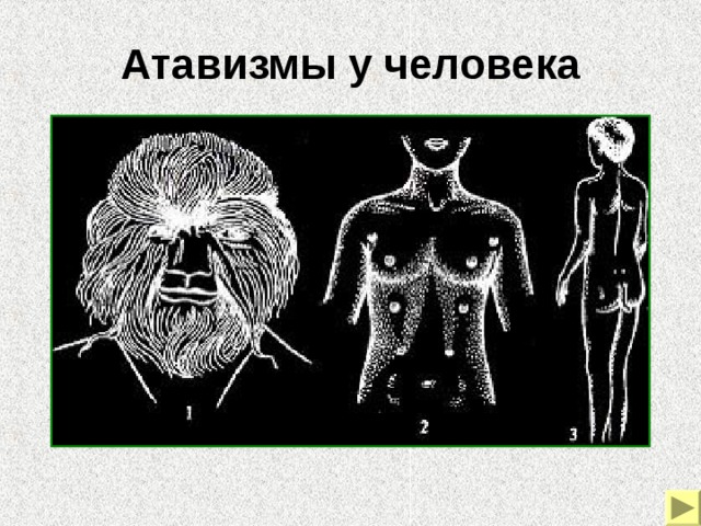 Атавизмы у человека Примеры морфологических доказательств эволюции. Атавизмы у человека – густой волосяной покров на лице и теле, развитие дополнительных пар млечных желез, хвостовой придаток.  