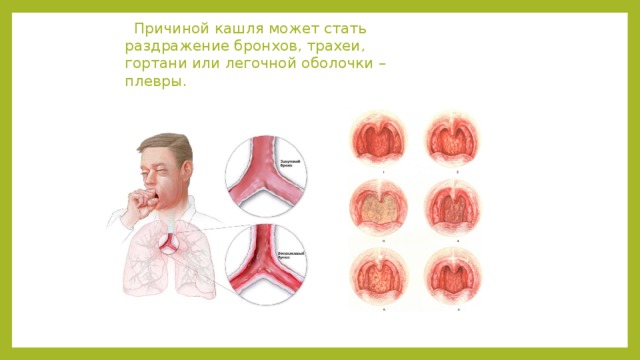  Причиной кашля может стать раздражение бронхов, трахеи, гортани или легочной оболочки – плевры. 