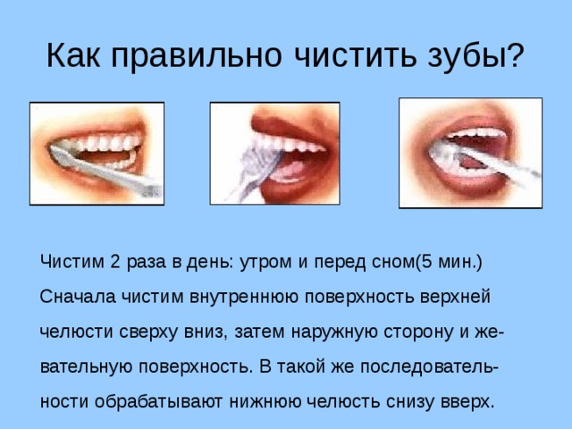 Как правильно чистить зубы? Чистим 2 раза в день: утром и перед сном(5 мин.) Сначала чистим внутреннюю поверхность верхней челюсти сверху вниз, затем наружную сторону и же- вательную поверхность. В такой же последователь- ности обрабатывают нижнюю челюсть снизу вверх. 