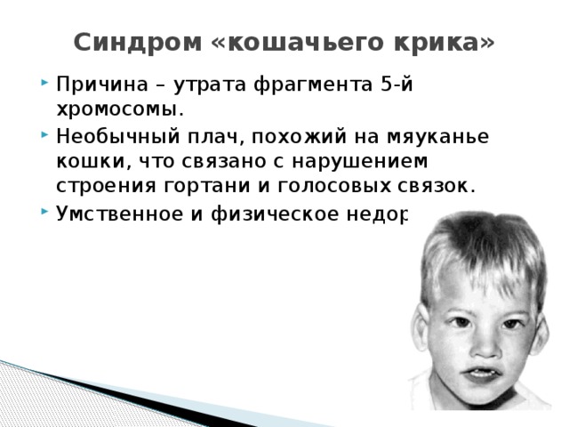 Каким номером на рисунке обозначен тип мутации характерный для больных с синдромом кошачьего крика