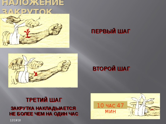 Минами 12. Шаг наслоения. Безопасные взрывающиеся закрутки.