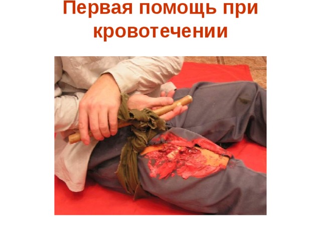 Первая помощь при кровотечении   