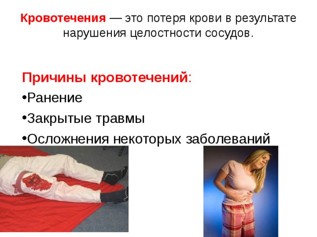 Кровотечения — это потеря крови в результате нарушения целостности сосудов. Причины кровотечений : Ранение Закрытые травмы Осложнения некоторых заболеваний  