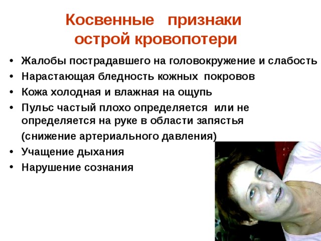 Косвенные признаки  острой кровопотери  Жалобы пострадавшего на головокружение и слабость Нарастающая бледность кожных покровов Кожа холодная и влажная на ощупь Пульс частый плохо определяется или не определяется на руке в области запястья  (снижение артериального давления) Учащение дыхания Нарушение сознания 