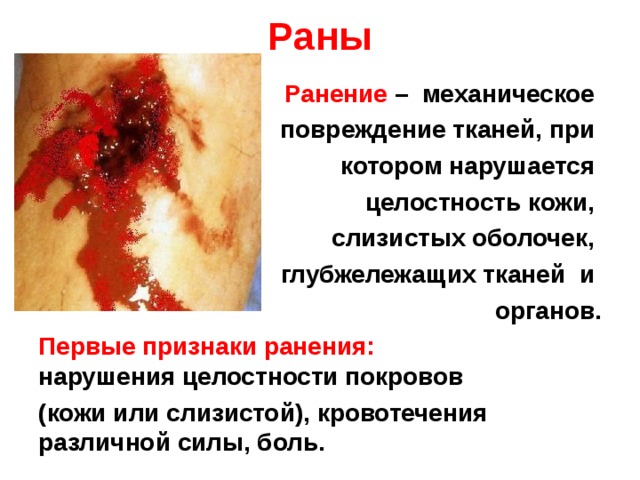 Раны Ранение – механическое повреждение тканей, при котором нарушается целостность кожи, слизистых оболочек, глубжележащих тканей и органов. Первые признаки ранения: нарушения целостности покровов (кожи или слизистой), кровотечения различной силы, боль.  