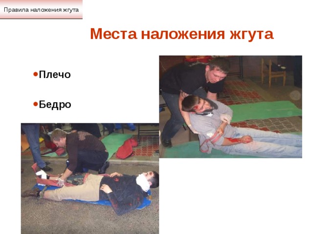 Правила наложения жгута Места наложения жгута Плечо  Бедро 