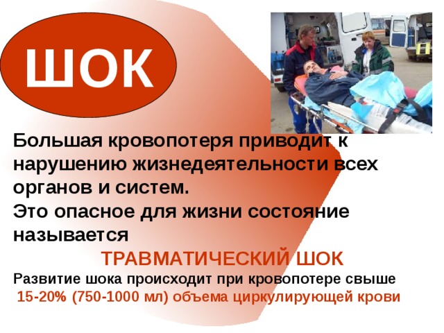 ШОК Большая кровопотеря приводит к нарушению жизнедеятельности всех органов и систем. Это опасное для жизни состояние называется ТРАВМАТИЧЕСКИЙ ШОК Развитие шока происходит при кровопотере свыше  15-20% (750-1000 мл) объема циркулирующей крови    