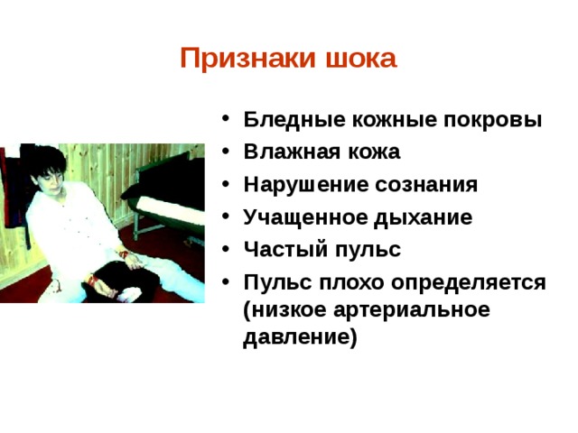  Признаки шока  Бледные кожные покровы Влажная кожа Нарушение сознания Учащенное дыхание Частый пульс Пульс плохо определяется (низкое артериальное давление) 