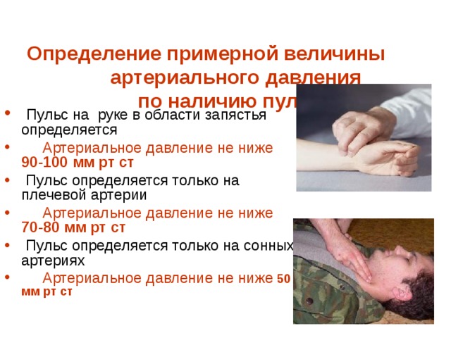  Определение примерной величины  артериального давления  по наличию пульса     Пульс на руке в области запястья определяется  Артериальное давление не ниже 90 - 100 мм рт ст  Пульс определяется только на плечевой артерии  Артериальное давление не ниже 70 - 80 мм рт ст   Пульс определяется только на сонных артериях  Артериальное давление не ниже 50 мм рт ст  