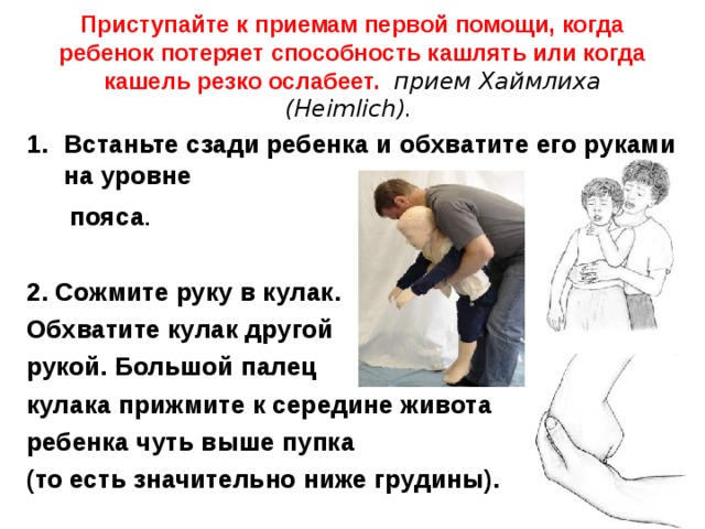 Приступайте к приемам первой помощи, когда ребенок потеряет способность кашлять или когда кашель резко ослабеет.  прием Хаймлиха (Heimlich). Встаньте сзади ребенка и обхватите его руками на уровне  пояса .   2. Сожмите руку в кулак. Обхватите кулак другой рукой. Большой палец кулака прижмите к середине живота ребенка чуть выше пупка (то есть значительно ниже грудины).    