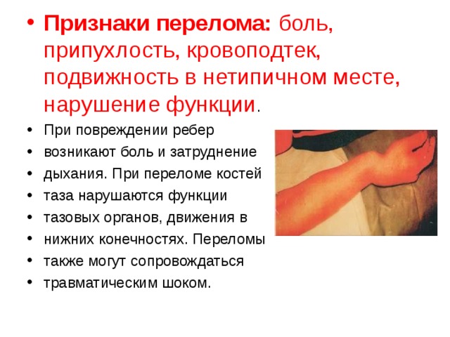 Признаки перелома: боль, припухлость, кровоподтек, подвижность в нетипичном месте, нарушение функции . При повреждении ребер возникают боль и затруднение дыхания. При переломе костей таза нарушаются функции тазовых органов, движения в нижних конечностях. Переломы также могут сопровождаться травматическим шоком.  