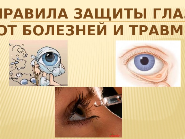 ПРАВИЛА ЗАЩИТЫ ГЛАЗ ОТ БОЛЕЗНЕЙ И ТРАВМ:  