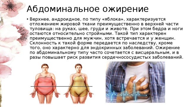 Абдоминальное ожирение что это. Абдоминальное ожирение характеризуется:. Ожирение по абдоминальному типу. Одмрение пот типу яблоко. Ожирение по верхнему типу.