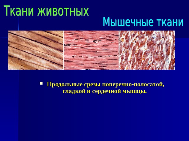 Поперечнополосатые мышцы входят в состав стенки