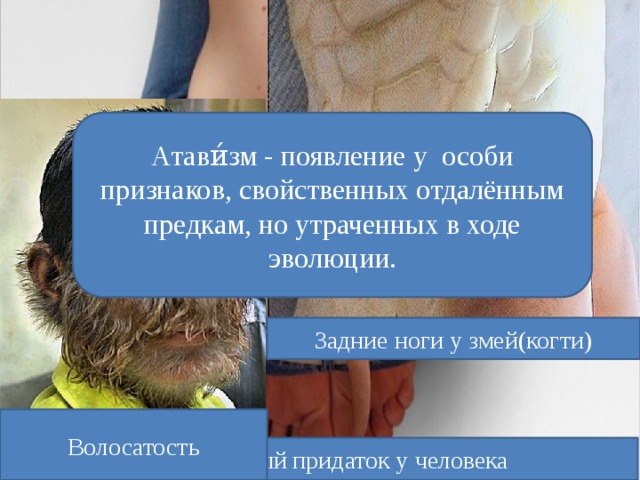 Атави́зм - появление у особи признаков, свойственных отдалённым предкам, но утраченных в ходе эволюции. Задние ноги у змей(когти) Волосатость Хвостовидный придаток у человека 