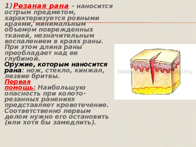 Резаная рана кисти карта вызова смп