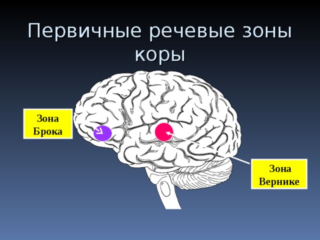 Первичные речевые зоны коры Зона Брока  Зона Вернике 