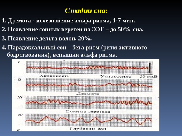 Стадии сна: 1. Дремота - исчезновение альфа ритма, 1-7 мин. 2. Появление сонных веретен на ЭЭГ – до 50 % сна. 3. Появление дельта волон, 20%. 4. Парадоксальный сон – бета ритм (ритм активного бодрствования), вспышки альфа ритма. 