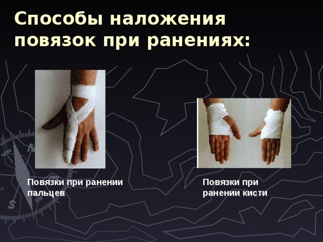 Способы наложения повязок при ранениях:  Повязки при ранении пальцев  Повязки при ранении кисти  