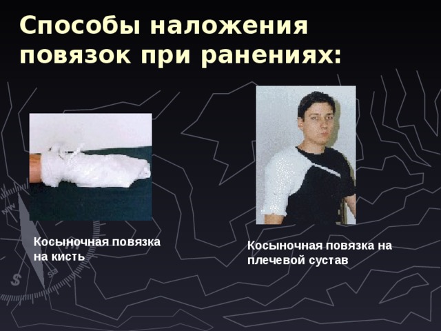 Способы наложения повязок при ранениях: Косыночная повязка на кисть  Косыночная повязка на плечевой сустав  