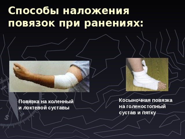 Способы наложения повязок при ранениях: Косыночная повязка на голеностопный сустав и пятку  Повязка на коленный и локтевой суставы  