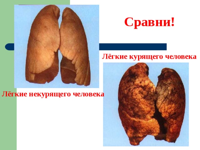 Сравни! Лёгкие курящего человека Лёгкие некурящего человека 