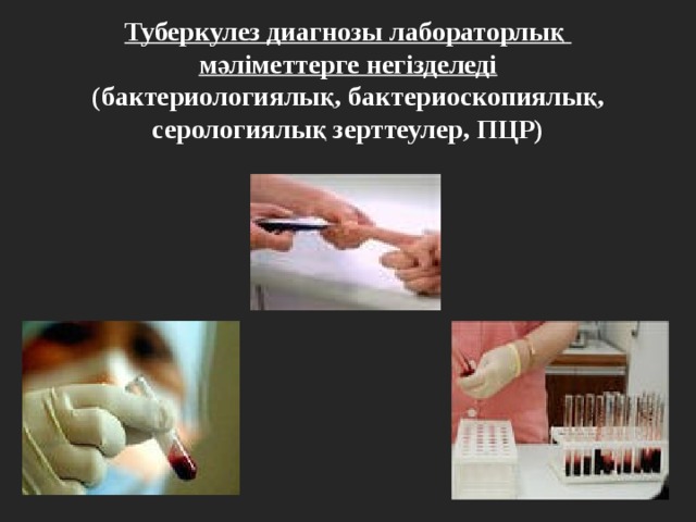 Туберкулез диагнозы лабораторлық мәліметтерге негізделеді  (бактериологиялық, бактериоскопиялық, серологиялық зерттеулер, ПЦР) 