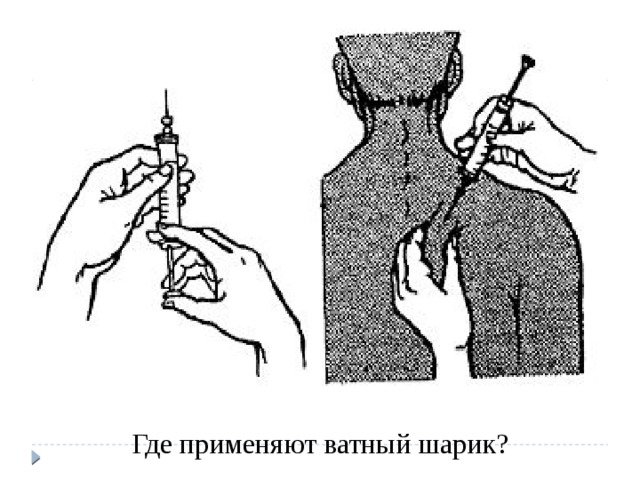 Где применяют ватный шарик? 