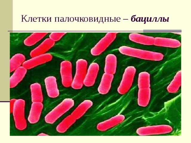 Клетки палочковидные – бациллы  