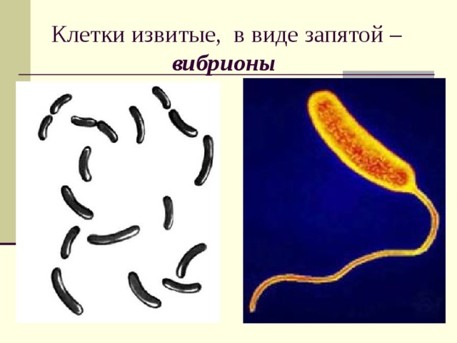 Клетки извитые, в виде запятой – вибрионы  