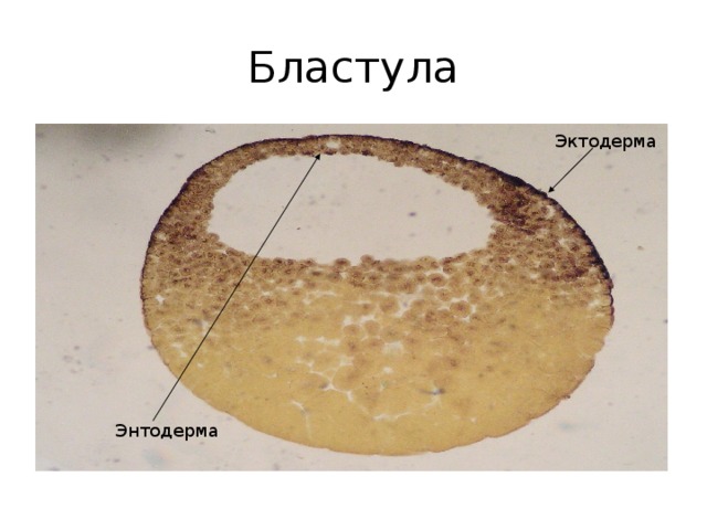 Бластула лягушки