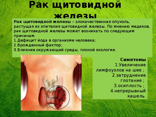 Рак щитовидной железы Рак щитовидной железы – злокачественная опухоль, растущая из эпителия щитовидной железы. По мнению медиков, рак щитовидной железы может возникать по следующим причинам: 1.Дефицит йода в организме человека; 2.Врожденный фактор; 3.Влияние окружающей среды, плохой экологии. Симптомы  1.Увеличение лимфоузлов на шее ;  2.затруднение глотание ;  3.осиплость ;  4.непрерывный кашель. Симптомы  