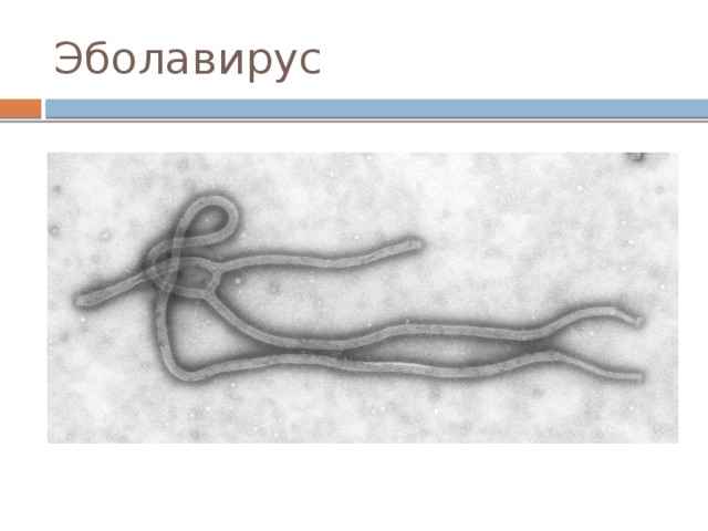 Эболавирус 