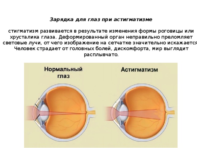 Зрение при астигматизме