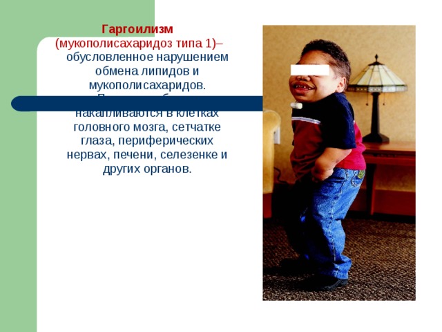 Мукополисахаридоз 2 типа презентация