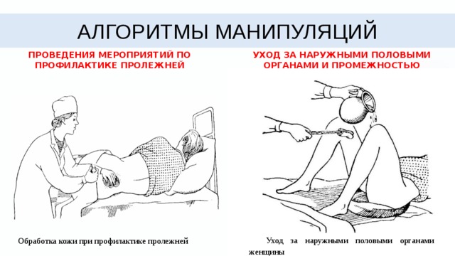 Алгоритмы манипуляций проведения мероприятий по профилактике пролежней уход за наружными половыми органами и промежностью Уход за наружными половыми органами женщины Обработка кожи при профилактике пролежней  