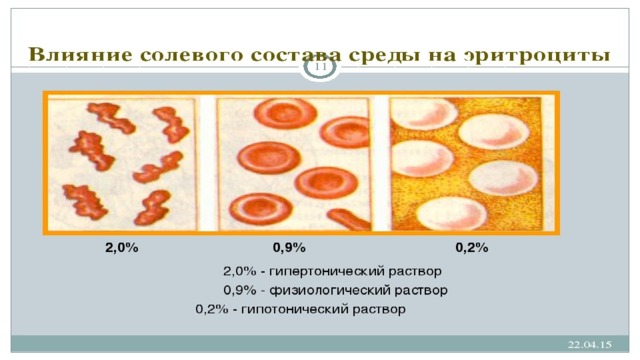 Ученые изучали действие на эритроциты раствора nacl. Эритроцит в гипотоническом и гипертоническом растворе. Гипертонический раствор эритроциты. Эритроциты в гипотоническом растворе. Эритроциты в гипертонической среде.