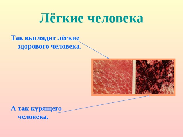 Лёгкие человека Так выглядят лёгкие здорового человека . А так курящего человека. 