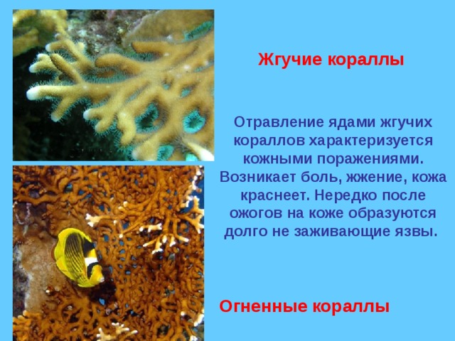 Жгучие кораллы Отравление ядами жгучих кораллов характеризуется кожными поражениями. Возникает боль, жжение, кожа краснеет. Нередко после ожогов на коже образуются долго не заживающие язвы.   Огненные кораллы 