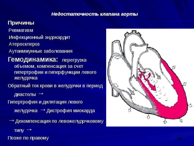 Причины аортальной недостаточности. Гемодинамика при аортальном стенозе. Открытый аортальный проток гемодинамика. Кт при инфекционном эндокардите аортального клапана.