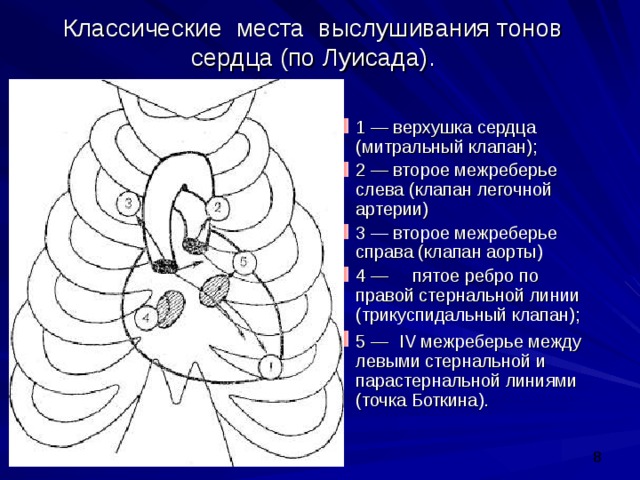 Аускультация сердца схема