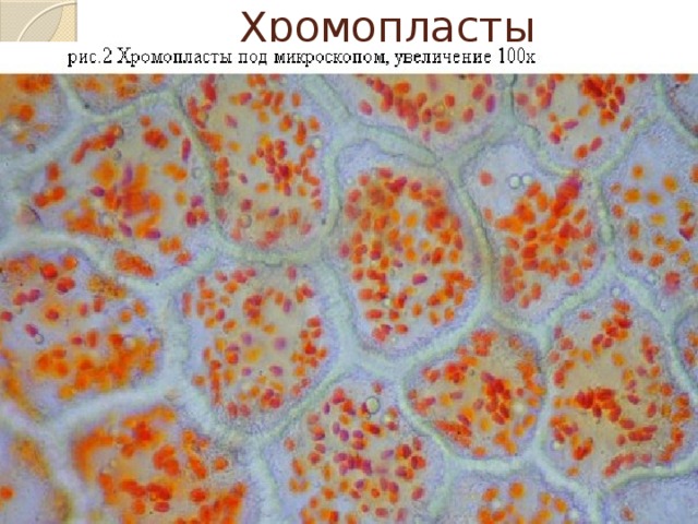 Клетка мякоти рябины. Хромопласт микрофотография. Хромопласты моркови под микроскопом. Хромопласты в клетках плодов шиповника. Хромопласты в клетках мякоти томата.