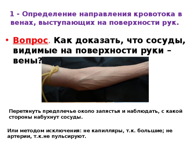 1 - Определение направления кровотока в венах, выступающих на поверхности рук.  Вопрос .   Как доказать, что сосуды, видимые на поверхности руки – вены?   Перетянуть предплечье около запястья и наблюдать, с какой стороны набухнут сосуды.    Или методом исключения: не капилляры, т.к. большие; не артерии, т.к.не пульсируют. 