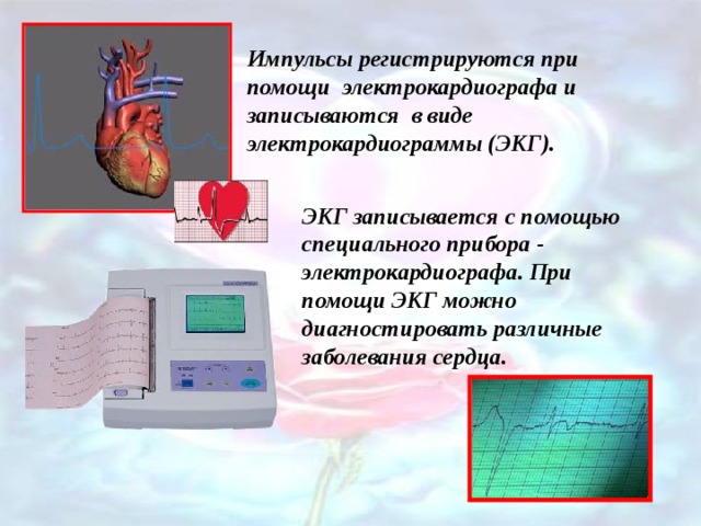 Импульсы регистрируются при помощи электрокардиографа и записываются в виде электрокардиограммы (ЭКГ). ЭКГ записывается с помощью специального прибора - электрокардиографа. При помощи ЭКГ можно диагностировать различные заболевания сердца. 