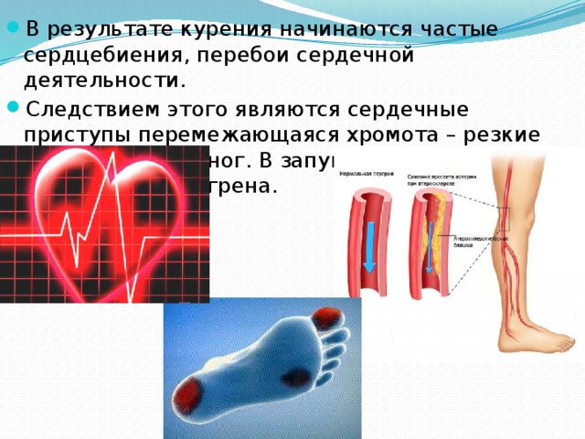 О вредекурения