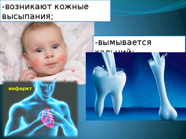-возникают кожные высыпания; -вымывается кальций; инфаркт 